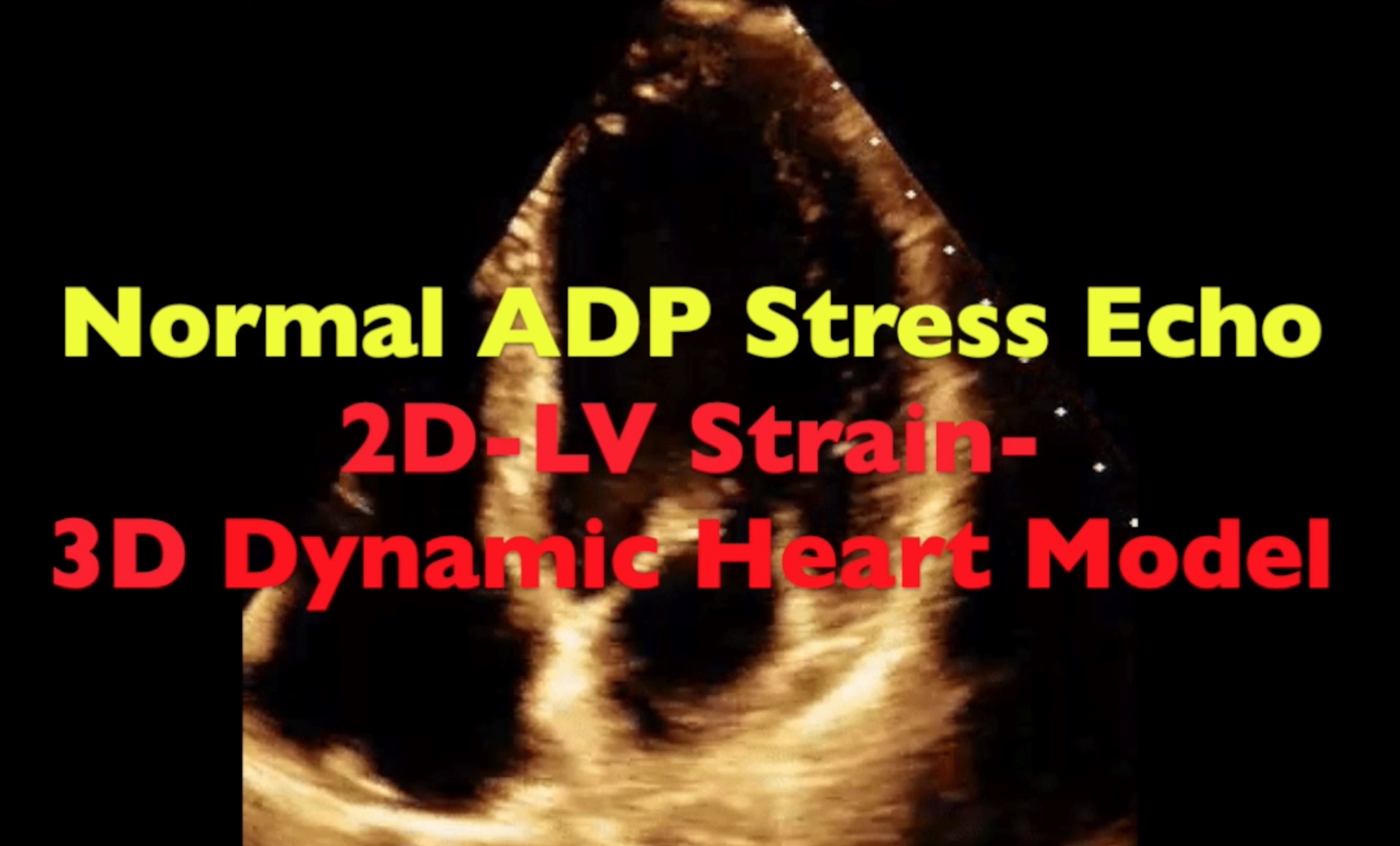 purpose-and-description-of-stress-test-echocardiogram-sydney